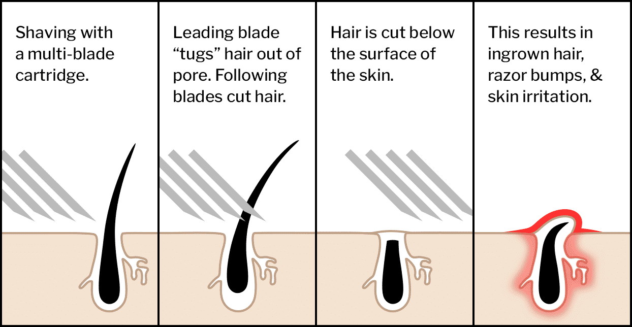 beard trimmer pulling hair